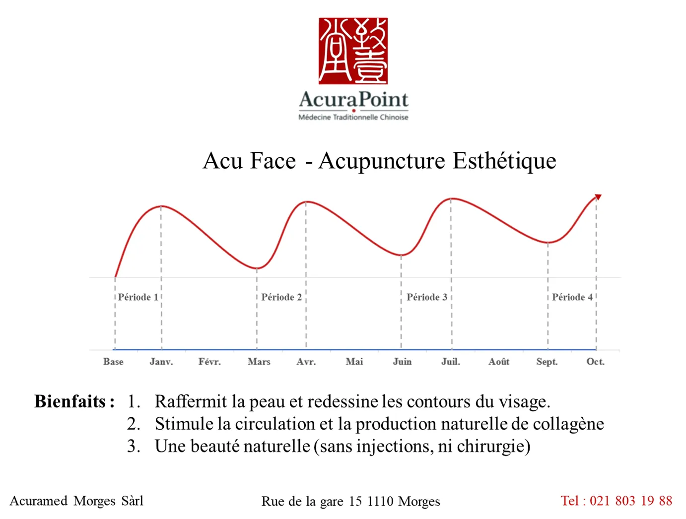 Acupuncture